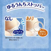 【1枚当たり21.1円】 ムーニー 新生児（お誕生～5kg） 152枚（76枚×2パック） 箱入り 【ユニ・チャーム テープタイプ】