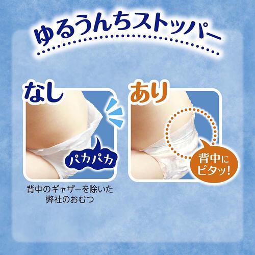 【1枚当たり21.1円】 ムーニー 新生児（お誕生～5kg） 152枚（76枚×2パック） 箱入り 【ユニ・チャーム テープタイプ】